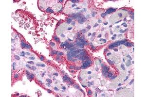 Immunohistochemistry (IHC) image for anti-Wingless-Type MMTV Integration Site Family, Member 5A (WNT5A) (Middle Region) antibody (ABIN2779470)