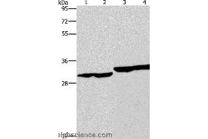 Western blot analysis of Human endometrial carcinoma and colon cancer tissue, human fetal liver tissue and PC3 cell, using DECR1 Polyclonal Antibody at dilution of 1:300 (DECR1 抗体)