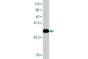 Western Blot detection against Immunogen (37. (ACAA2 抗体  (AA 151-260))