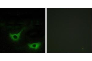 Immunofluorescence analysis of NIH/3T3 cells, using CALR antibody. (Calreticulin 抗体)