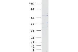 Western Blotting (WB) image for Polo-Like Kinase 2 (PLK2) protein (Myc-DYKDDDDK Tag) (ABIN2729186)