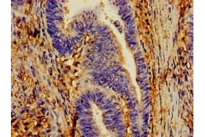 Immunohistochemistry of paraffin-embedded human lung tissue using ABIN7149202 at dilution of 1:100 (CYP1A1 抗体  (AA 97-254))