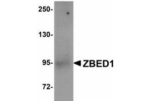 Image no. 1 for anti-Zinc Finger, BED-Type Containing 1 (ZBED1) (Internal Region) antibody (ABIN478064) (ZBED1 抗体  (Internal Region))