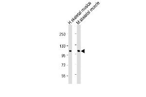 All lanes : Anti-CLCN1 Antibody (N-Term) at 1:2000 dilution Lane 1: Human skeletal muslce lysate Lane 2: Mouse skeletal muscle lysate Lysates/proteins at 20 μg per lane. (CLCN1 抗体  (AA 32-66))