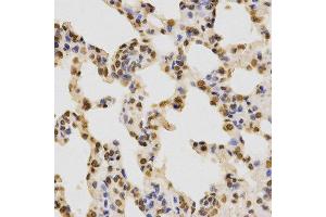 Immunohistochemistry (IHC) image for anti-Histone 3 (H3) (H3K36me2) antibody (ABIN3016036)