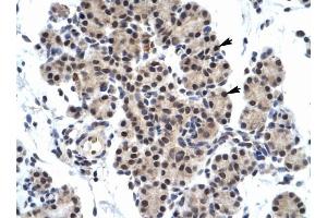 ZNF318 antibody was used for immunohistochemistry at a concentration of 4-8 ug/ml to stain Epithelial cells of pancreatic acinus (arrows) in Human Pancreas. (ZNF318 抗体  (N-Term))