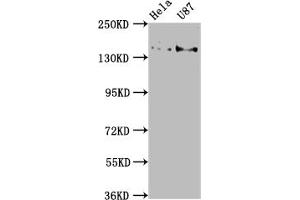 Western Blot Positive WB detected in: Hela whole cell lysate, U87 whole cell lysate All lanes: MYO5A antibody at 1:2000 Secondary Goat polyclonal to rabbit IgG at 1/50000 dilution Predicted band size: 216, 213, 219 kDa Observed band size: 216 kDa (MYO5A 抗体  (AA 1087-1220))