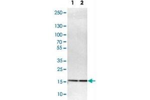 Western Blot analysis of Lane 1: NIH-3T3 cell lysate (mouse embryonic fibroblast cells) and Lane 2: NBT-II cell lysate (Wistar rat bladder tumor cells) with UBE2I polyclonal antibody .