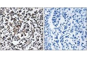 Immunohistochemistry (IHC) image for anti-Solute Carrier Family 30 (Zinc Transporter), Member 4 (SLC30A4) (AA 71-120) antibody (ABIN1535486)