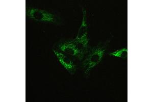IHC analysis of ATX2 using anti-ATX2 antibody . (Ataxin 2 抗体  (C-Term))