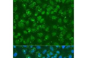 Immunofluorescence analysis of U2OS cells using DGKE Polyclonal Antibody at dilution of 1:100. (DGKE 抗体)