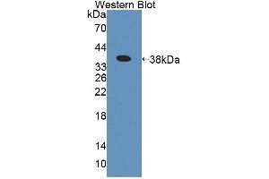 Figure. (Amyloid beta Precursor Protein Binding Protein 1 (AA 229-534) 抗体)