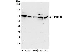 anti-Protein Kinase C Substrate 80K-H (PRKCSH) (AA 1-50) antibody