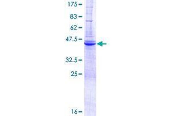 ZBP1 Protein (AA 1-149) (GST tag)