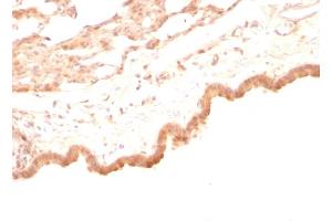 Immunohistochemistry (IHC) image for anti-Glypican 3 (GPC3) antibody (ABIN6939525)