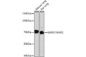 Western blot analysis of extracts of various cell lines, using G/G Rabbit mAb (ABIN7267410) at 1:1000 dilution. (GAD 抗体)