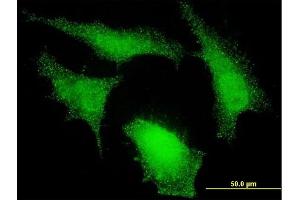 Immunofluorescence (IF) image for anti-Neural Precursor Cell Expressed, Developmentally Down-Regulated 9 (NEDD9) (AA 101-200) antibody (ABIN561951)
