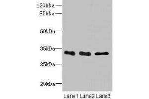 Western blot All lanes: EXOSC8 antibody at 4 μg/mL Lane 1: Mouse small intestine tissue Lane 2: Hela whole cell lysate Lane 3: K562 whole cell lysate Secondary Goat polyclonal to rabbit IgG at 1/10000 dilution Predicted band size: 31 kDa Observed band size: 31 kDa (EXOSC8 抗体  (AA 2-276))
