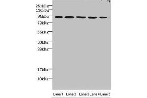 Western blot All lanes: THOC1 antibody at 3 μg/mL Lane 1: Jurkats whole cell lysate Lane 2: 293T whole cell lysate Lane 3: HepG2 whole cell lysate Lane 4: A549 whole cell lysate Lane 5: Mouse kidney tissue Secondary Goat polyclonal to rabbit IgG at 1/10000 dilution Predicted band size: 76, 44 kDa Observed band size: 76 kDa (THOC1 抗体  (AA 428-657))