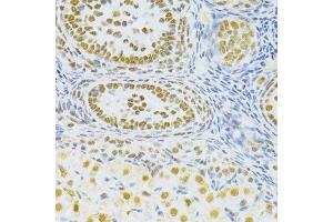 Immunohistochemistry of paraffin-embedded rat ovary using SNRNP70 antibody. (SNRNP70 抗体  (AA 150-250))