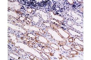 Immunohistochemistry (Paraffin-embedded Sections) (IHC (p)) image for anti-Collagen, Type XVIII, alpha 1 (COL18A1) (AA 1581-1680) antibody (ABIN669951)