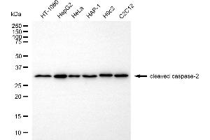 Western blotting analysis using cleaved caspase-2 antibody (ABIN7797889).