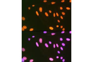 Immunofluorescence analysis of U-2 OS cells using EWSR1 Rabbit mAb (ABIN7267053) at dilution of 1:100 (40x lens). (EWSR1 抗体)