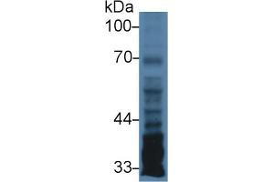Western Blot; Sample: Human U87MG cell lysate; Primary Ab: 3µg/ml Rabbit Anti-Human PTX3 Antibody Second Ab: 0. (PTX3 抗体  (AA 183-381))