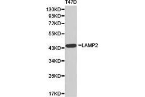 Western Blotting (WB) image for anti-Lysosomal-Associated Membrane Protein 2 (LAMP2) antibody (ABIN1873504) (LAMP2 抗体)