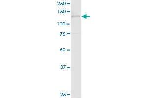 TIMELESS MaxPab rabbit polyclonal antibody. (TIMELESS 抗体  (AA 1-1208))