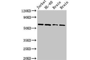 Western Blot Positive WB detected in: Jurkat whole cell lysate, HL60 whole cell lysate, Rat brain tissue, Mouse brain tissue All lanes: ARX antibody at 2. (Arx 抗体  (AA 381-460))