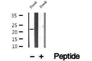 Western blot analysis of extracts of Daudi cells, using CHCHD4 antibody. (CHCHD4 抗体  (N-Term))