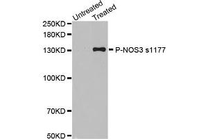 Western Blotting (WB) image for anti-Nitric Oxide Synthase 3 (Endothelial Cell) (NOS3) (pSer1177) antibody (ABIN1870485) (ENOS 抗体  (pSer1177))