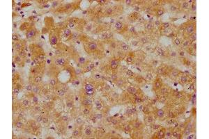 IHC image of ABIN7127423 diluted at 1:115 and staining in paraffin-embedded human liver tissue performed on a Leica BondTM system. (Recombinant CETP 抗体)