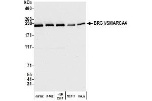 Western Blotting (WB) image for anti-SWI/SNF Related, Matrix Associated, Actin Dependent Regulator of Chromatin, Subfamily A, Member 4 (SMARCA4) (AA 75-125) antibody (ABIN7454677)