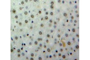 Immunohistochemistry (IHC) image for anti-cAMP Responsive Element Binding Protein 1 (CREB1) (AA 102-341) antibody (ABIN7443032)