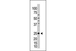 The ICOS polyclonal antibody  is used in Western blot to detect ICOS in HL-60 cell lysate. (ICOS 抗体  (C-Term))