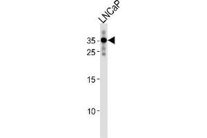 Western blot analysis in LNCaP cell line lysates (35ug/lane) using RNF4 Antibody (C-term) Cat. (RNF4 抗体  (C-Term))