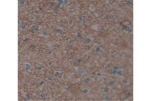 IHC-P analysis of Human Tissue, with DAB staining. (UACA 抗体  (AA 29-209))