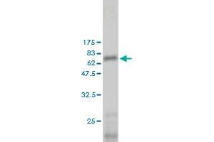 Western Blot detection against Immunogen (65. (LGALS8 抗体  (AA 1-358))