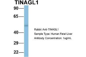 Western Blotting (WB) image for anti-Tubulointerstitial Nephritis Antigen-Like 1 (TINAGL1) (Middle Region) antibody (ABIN2787305)