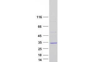 Western Blotting (WB) image for SplA/ryanodine Receptor Domain and SOCS Box Containing 4 (SPSB4) protein (Myc-DYKDDDDK Tag) (ABIN2732626)
