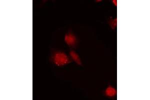 ABIN6272286 staining LOVO by IF/ICC. (RBM6 抗体  (N-Term))