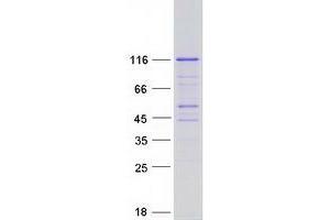 Western Blotting (WB) image for phosphofurin Acidic Cluster Sorting Protein 2 (PACS2) (Transcript Variant 1) protein (Myc-DYKDDDDK Tag) (ABIN2728108)
