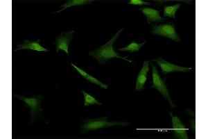 Immunofluorescence of purified MaxPab antibody to BIRC5 on HeLa cell. (Survivin 抗体  (AA 1-142))