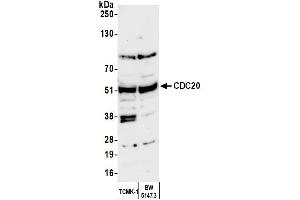 Western Blotting (WB) image for anti-Cell Division Cycle 20 Homolog (S. Cerevisiae) (CDC20) (AA 449-499) antibody (ABIN7454724)