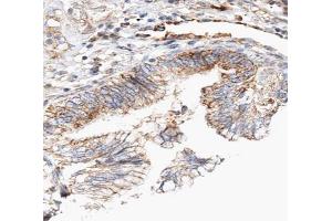 ABIN6266837 at 1/100 staining human lung tissue sections by IHC-P. (Claudin 7 抗体  (C-Term))