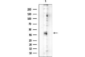 Western blot analysis of lysates from MCF7 cells, using MURC Mouse Monoclonal Antibody at 1/1000 dilution. (MURC 抗体)