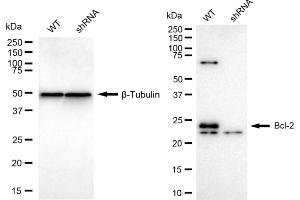Western blotting analysis using Bcl-2 antibody (ABIN7797719). (Recombinant Bcl-2 抗体)