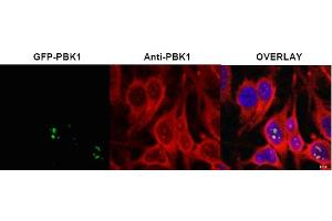 Image no. 1 for anti-Ribosomal L1 Domain Containing 1 (RSL1D1) (Internal Region) antibody (ABIN401398) (RSL1D1 抗体  (Internal Region))